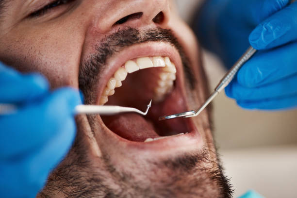 Best Emergency Dental Care for Broken or Chipped Teeth in Pooler, GA