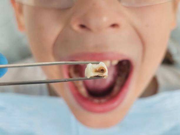 Best Same-Day Emergency Dental Services in Pooler, GA